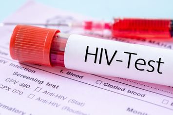 Causas y repercusiones VIH SIDA